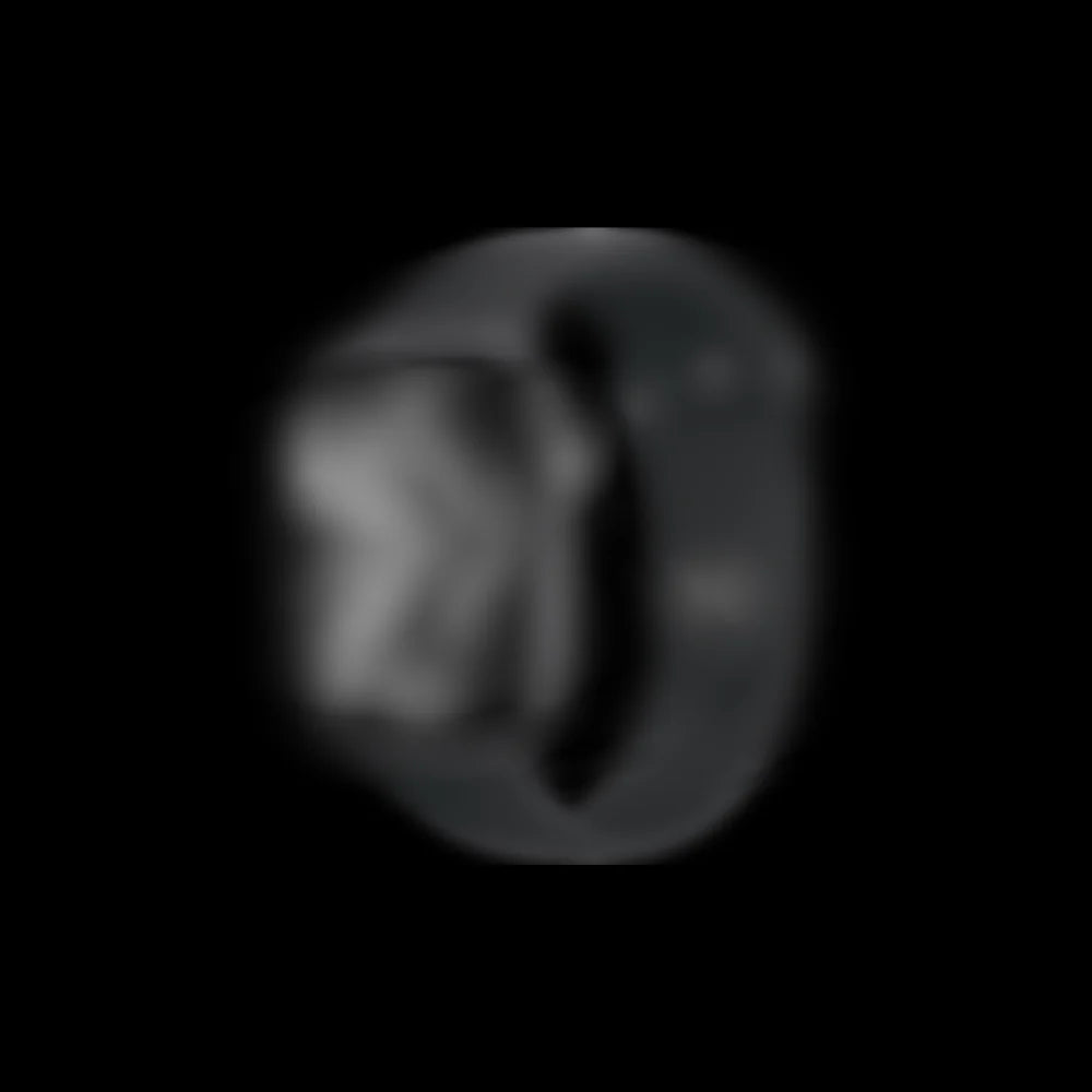 A WATCH SRS 11 SUPPLIER