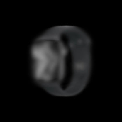 A WATCH SRS 11 SUPPLIER